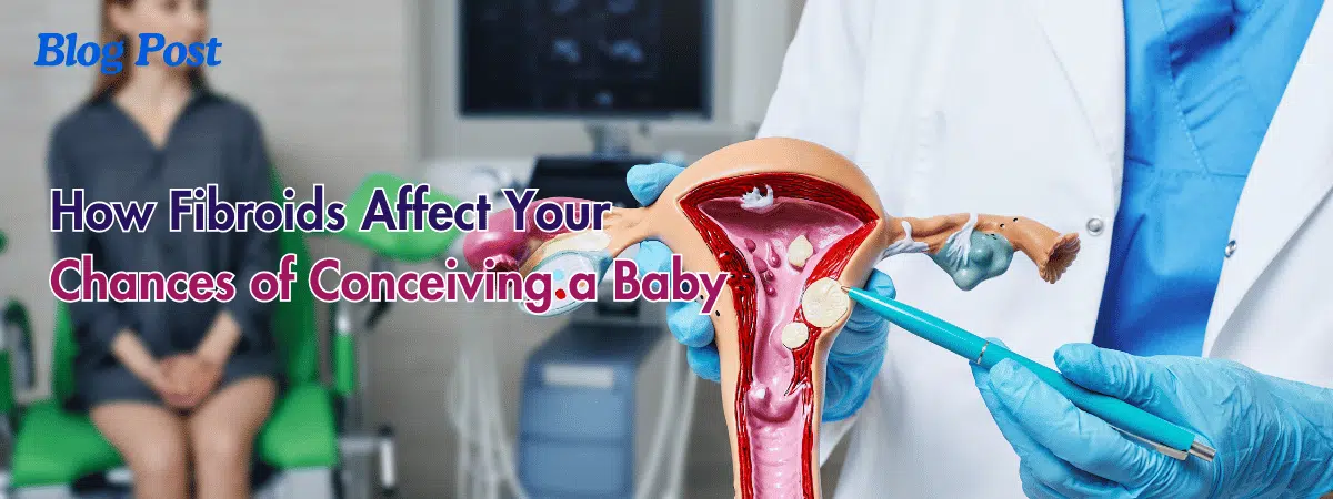 How Fibroids Affect Your Chances of Conceiving a Baby