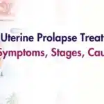 Uterine Prolapse Treatment in Solapur